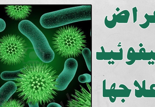التيفود